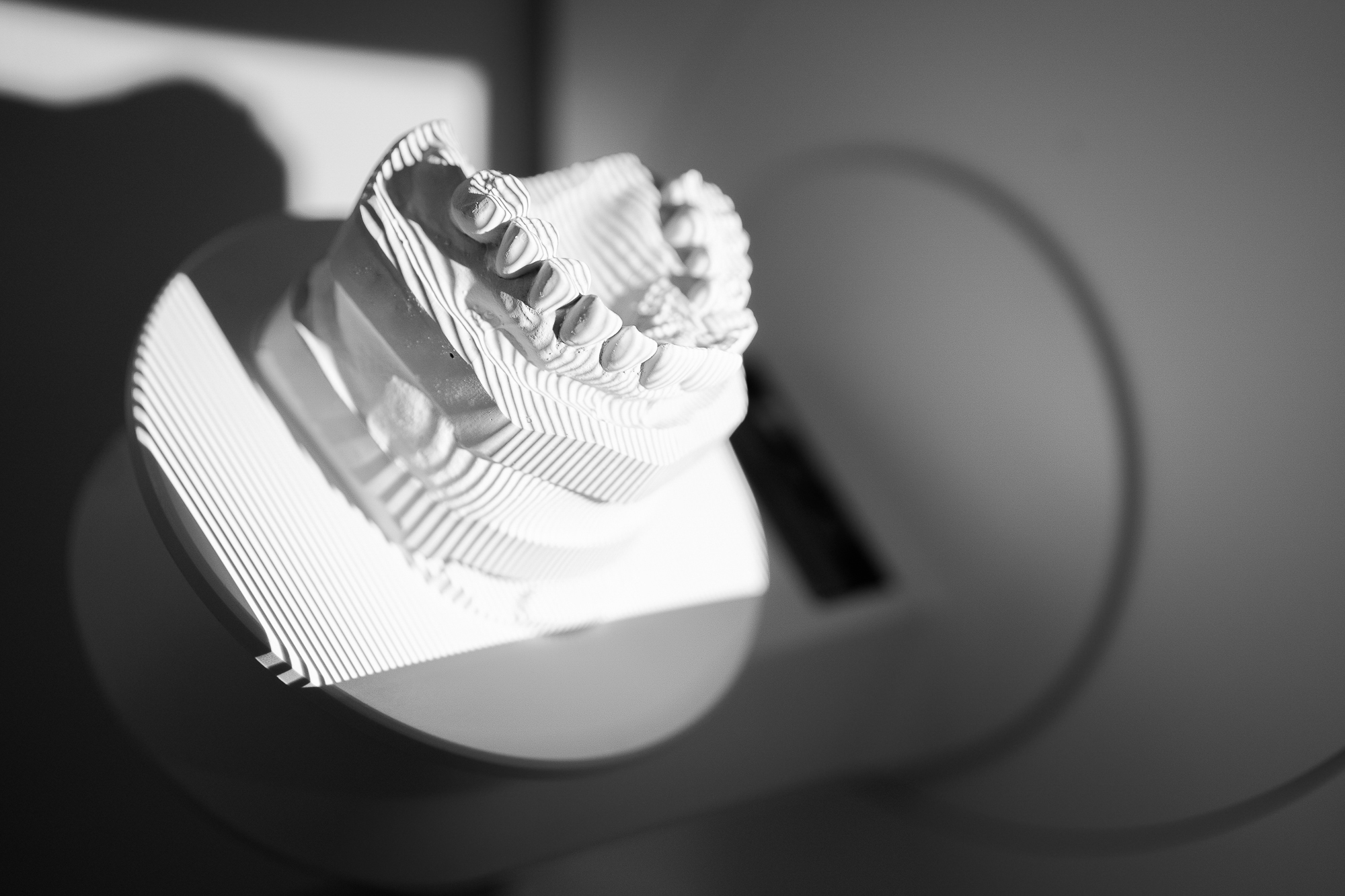 Der 3D Scanner erfasst das Zahnmodell zur digitalen Weiterverarbeitung im CAD Progamm